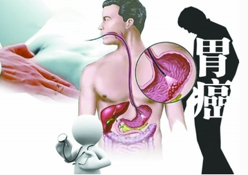 png QQ图片20160816172143.png