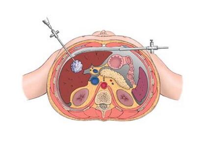 jpg QQ截图20160830160729.jpg